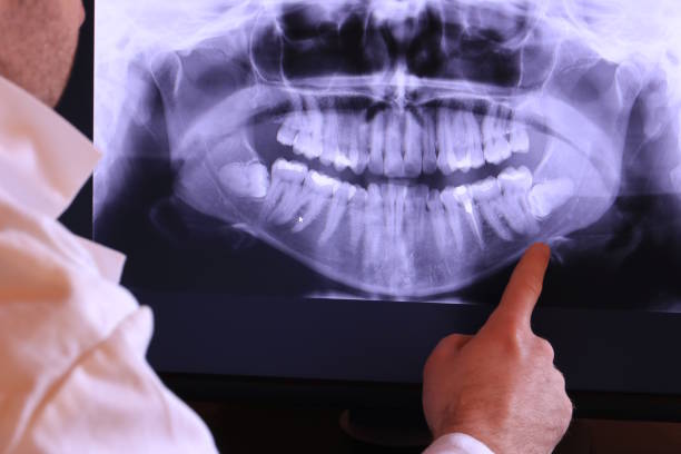 Best Emergency Treatment for Toothache in Pell City, AL